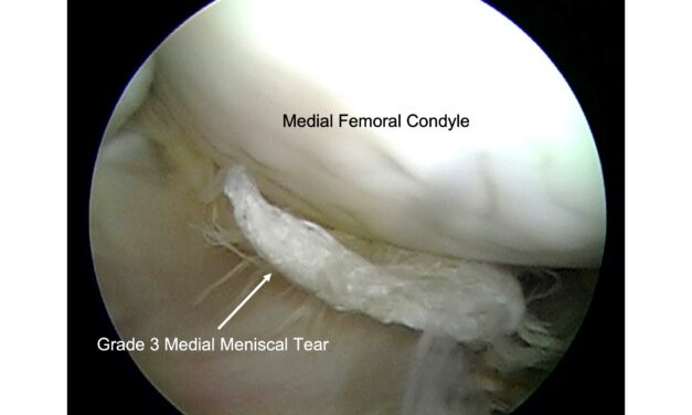 Equine Meniscal Injuries