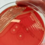 S. Aureus a Contributing Factor in Equine Pastern Dermatitis