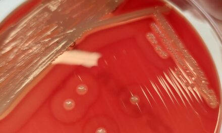 S. Aureus a Contributing Factor in Equine Pastern Dermatitis