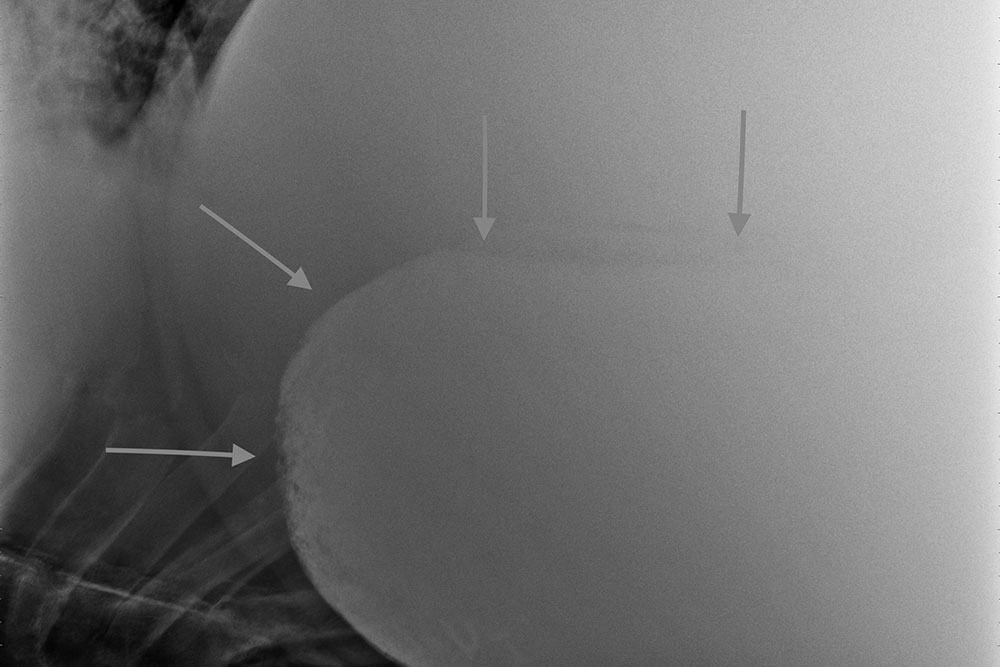 radiograph of significant sand accumulation in the large colon