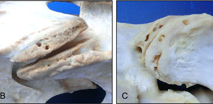 Interpreting Imaging of the Equine Neck
